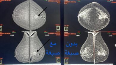 صورة واتساب بتاريخ 2023 12 12 في 13.31.19 97ce5d5e