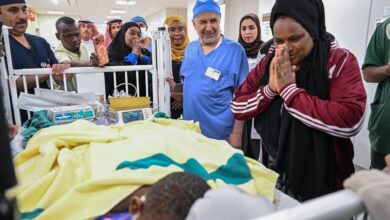 نجاح عملية فصل التوأم الملتصق التنزاني (لايتيينس ولوفنس) 2 WhatsApp Image 2026 10 30 at 2.40.16 PM